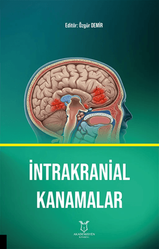 İntrakranial Kanamalar