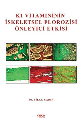 K1 Vitamininin İskeletsel Florozisi Önleyici Etkisi