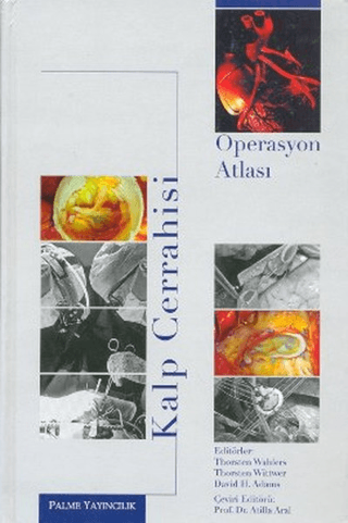Kalp Cerrahisi Operasyon Atlası