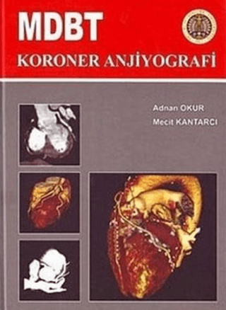 MDBT Koroner Anjiyografi