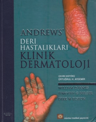 Andrews’ Deri Hastalıkları Klinik Dermatoloji